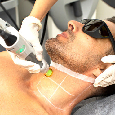 Laser Hair Removal