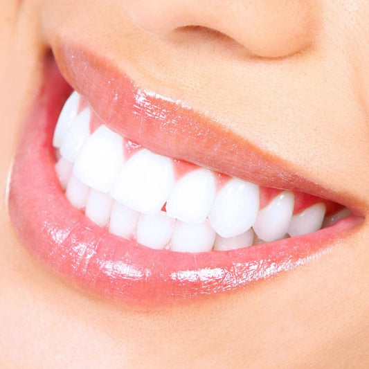 Teeth Whitening - Beaming Beauty