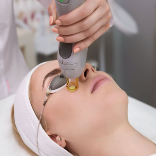 Laser Photo Facial (IPL)